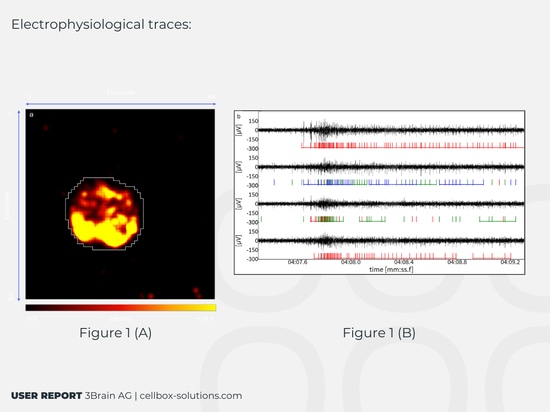 Electrophysiological traces: