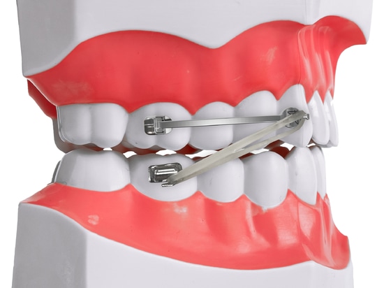 Bring Class II patients to Class I by using D-bar
