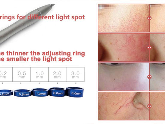 980nm diode laser working principle and introduce