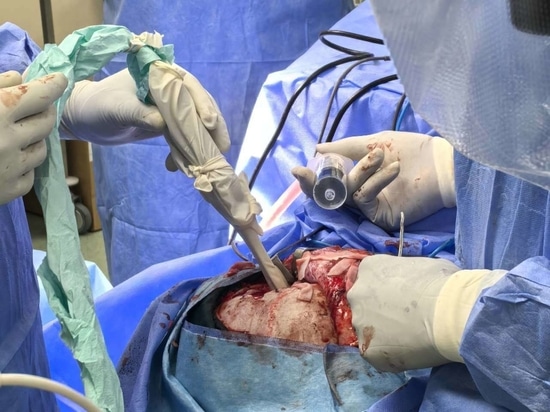 NPUS-01: The Portable Ultrasound Device Designed for Neurosurgery