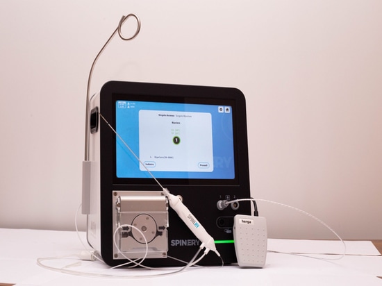 Radiofrequency Ablation for the Treatment of Bone Metastases: Results of the SPARTA Study