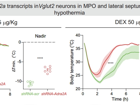 dex-induced hypothermia