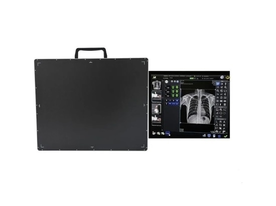 Portable DR: Double the Physical Examination Efficiency & Core Advantages