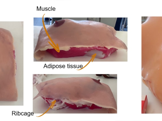 3D Innovation Lab introduces a new patient‑specific 3D‑printed breast phantom designed to elevate oncoplastic surgical training — a breakthrough innovation recently published in BMC Surgery.