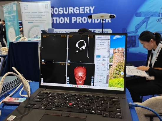 HUIDAMED AACNS 2026 in Manila , Driving Innovation in Neurosurgery