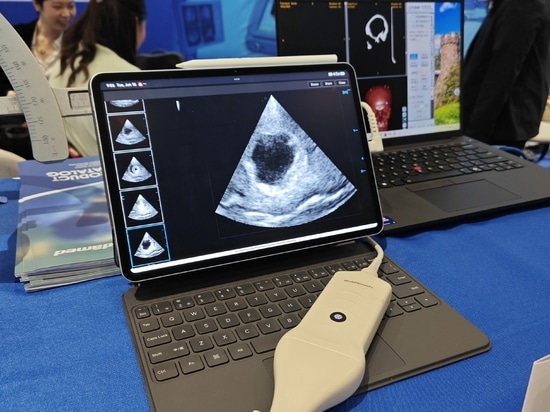 HUIDAMED AACNS 2026 in Manila , Driving Innovation in Neurosurgery