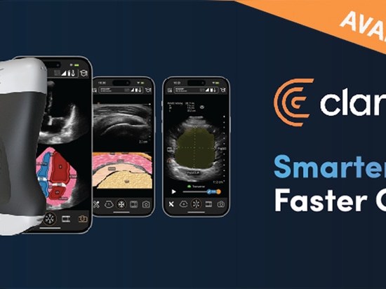 Cardiac Ultrasound, Demystified: How AI Labeling Is Bringing the Heart Into Primary Care