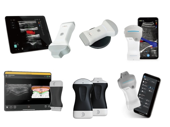 Wireless Ultrasound Probe Buying Guide