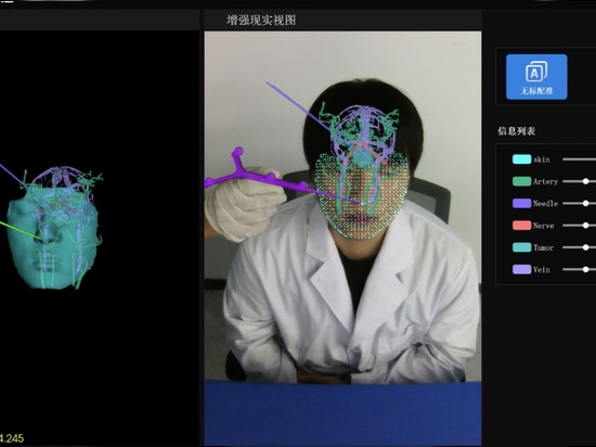 Ruitong SE 3D real-time makerless tracking