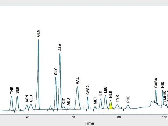 Amino Acid Analysis as a Basis for Personalized Preventive Healthcare