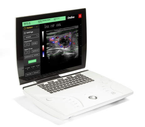 Sonoscanner Photo 2