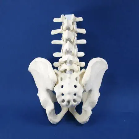 腰骨辺りの模型 可哀想