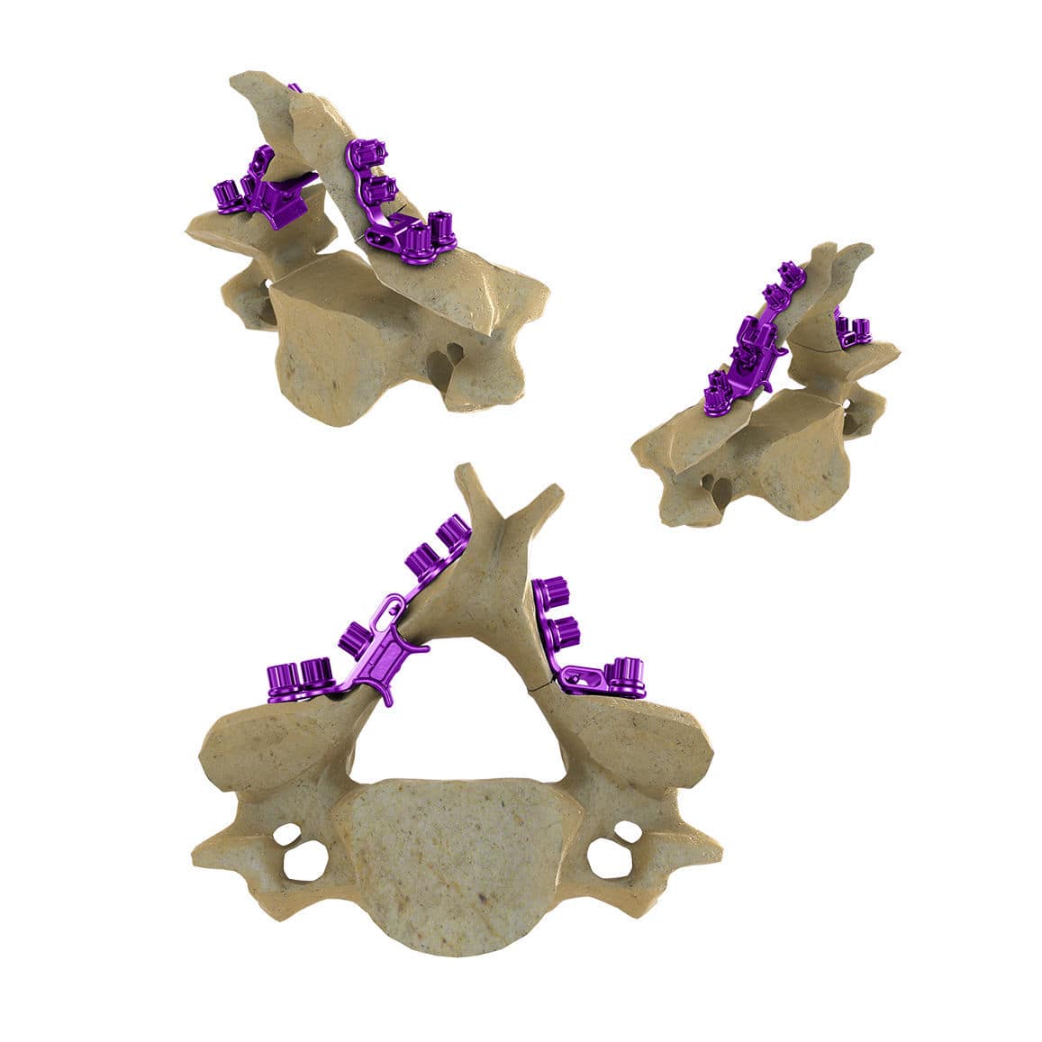 頸椎スプレッダー 成形副木/頸部固定帯/頸椎カラー カラーキーパー・ハード L