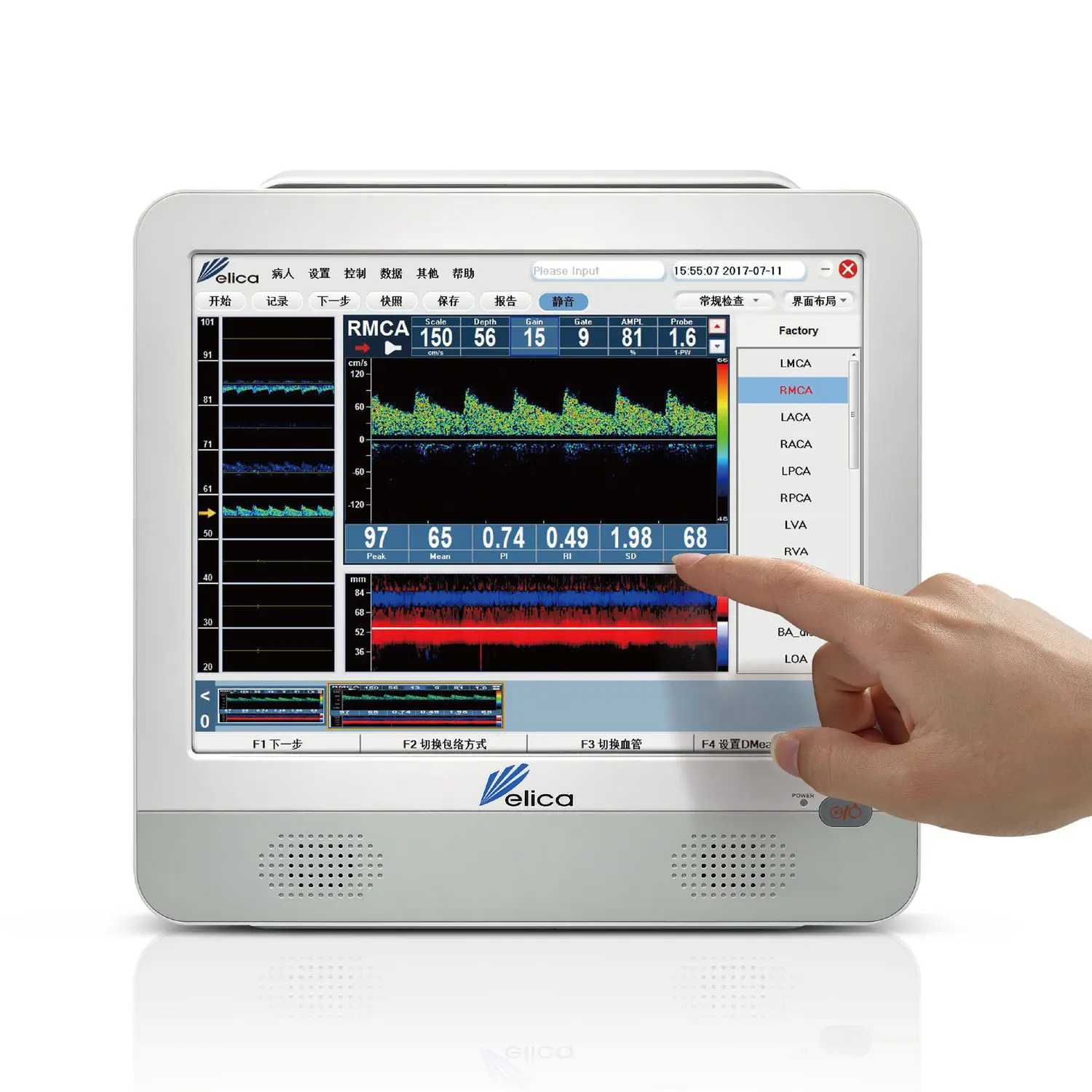 経頭蓋超音波ドップラー - EMS-9D PRO - Shenzhen Delica Medical 