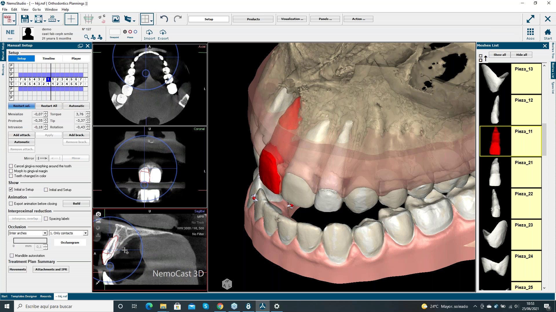 T.K.M.キャストデンチャーのすべてBio-Mimetic Cast Denture T.K.M.キャストデンチャーのすべてBio-Mimetic Cast Denture