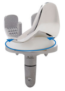 全人工膝関節置換術用人工膝関節 - GEMINI® SL® - Waldemar Link