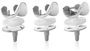 人工膝関節置換術 人工膝関節手術について | 名古屋整形外科 人工関節クリニック