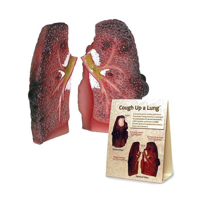 HEALTH EDCO 喫煙の影響 人体模型セット Smoking Health Consequences 3-D Display | Health Edco
