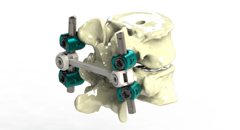 YUKO フレックスホーン#SC180 BC76.0 YUKO フレックスホーン#SC180 BC型 シリコンカーバイド軸径3.7mm SC180