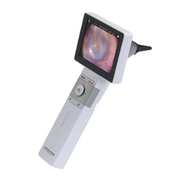高解像度ビデオ耳鏡 - Visionflex - 超高解像度 / ビデオモニター搭載 