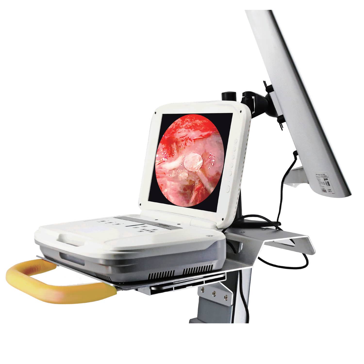 神経内視鏡手術アトラス 神経内視鏡手術アトラス | 書籍詳細 | 書籍 | 医学書院