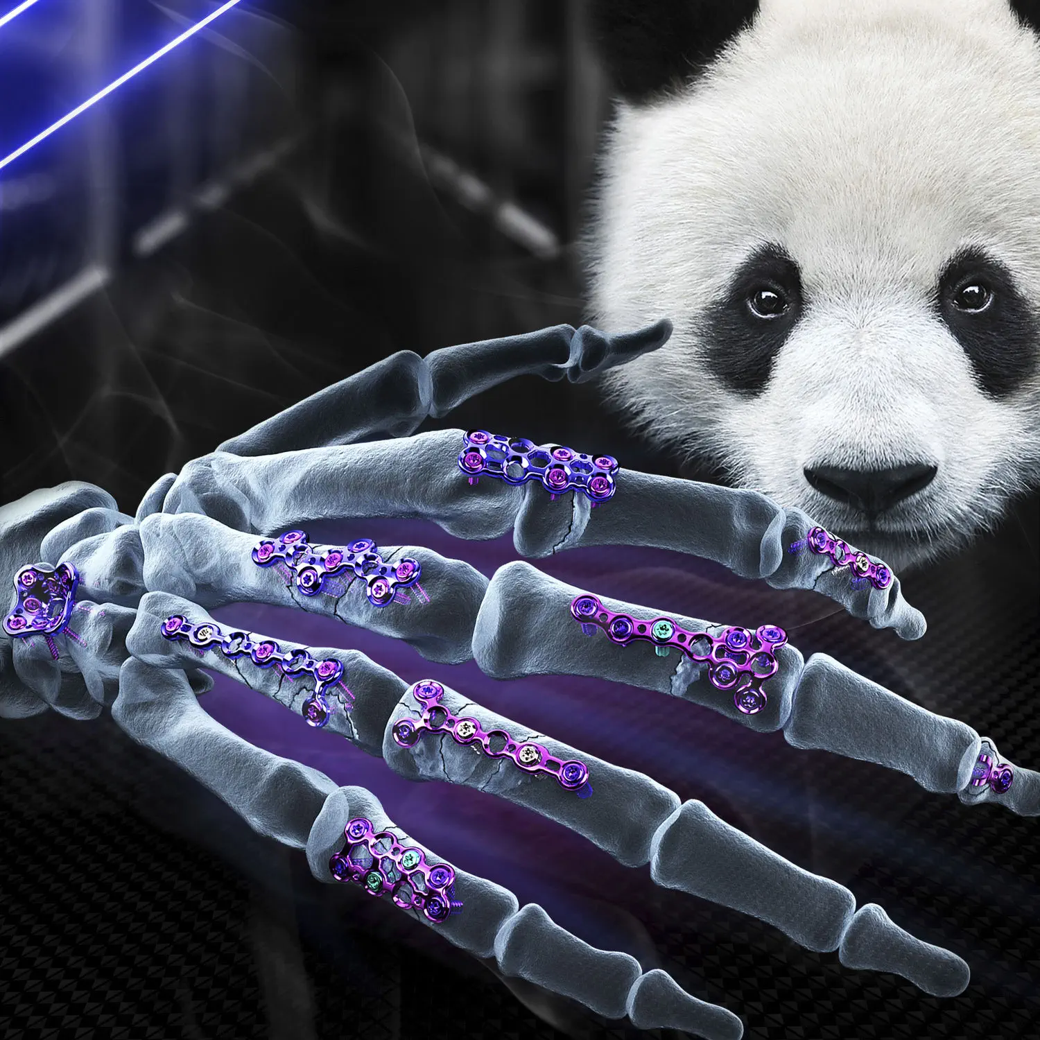 指骨用圧迫プレート - PANDA - AGOMED Medizin-Technik - 中手指