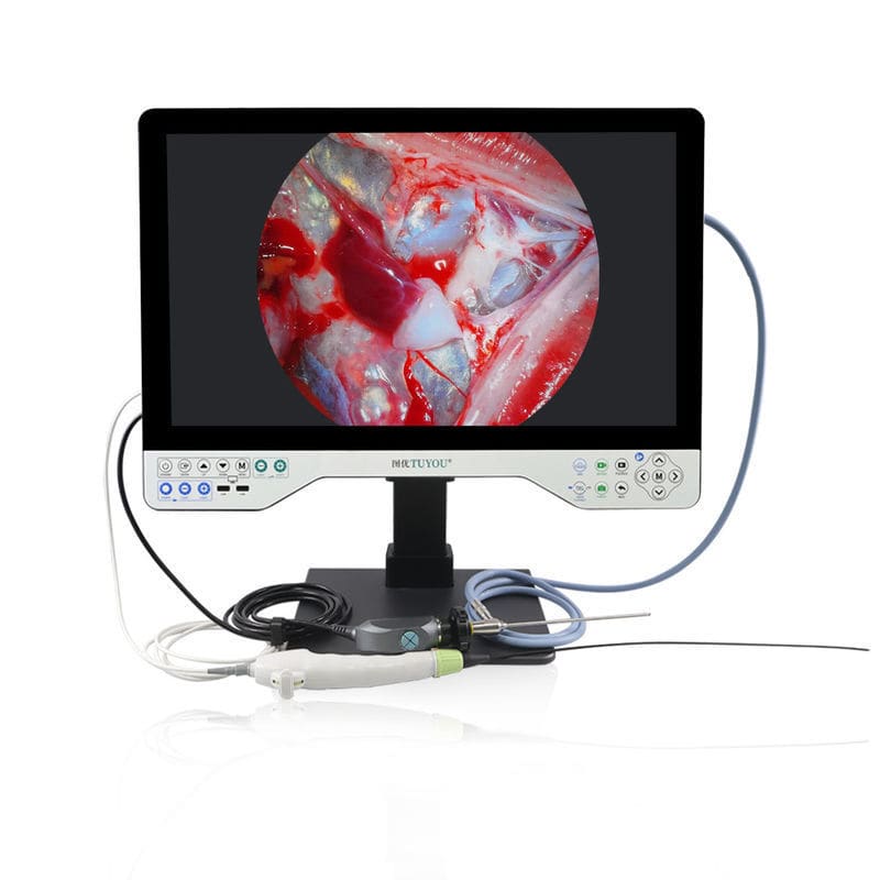 硬性内視鏡用カメラ - TU-24LSD1B - Shenzhen Tuyou Medical Imaging Co., Ltd. - 医療用 ...