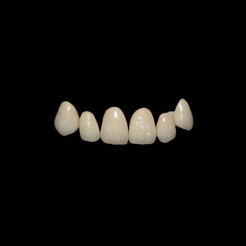 ジルコニア製歯冠 - Shenzhen Alcadent Co.Ltd Alcadent Dental Laboratory - 上門歯 / 奥歯