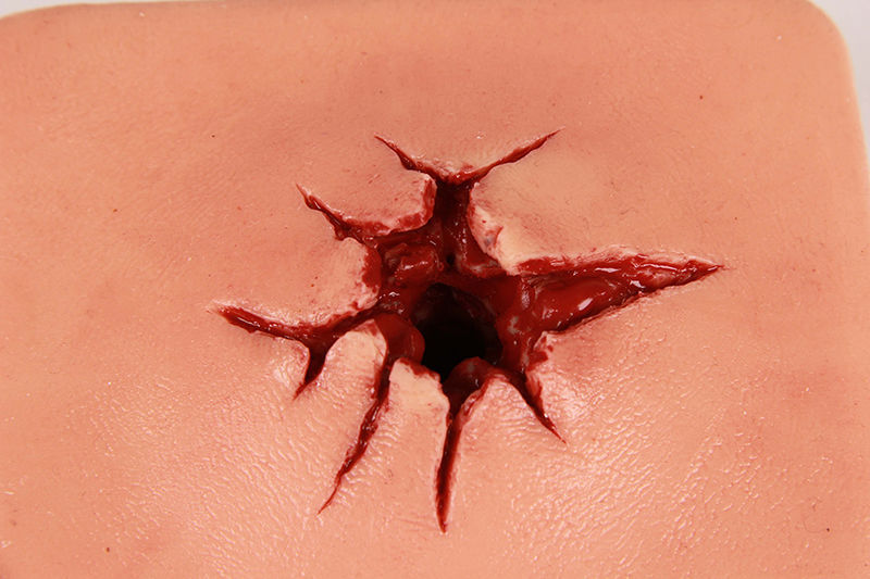 銃創管理シミュレーター 7770 Erler Zimmer