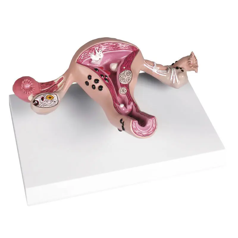 Erler-Zimmer 頸椎モデル 模型 Erler-Zimmer 頸椎モデル 模型 Amazon.co.jp: ERLER ZIMMER (ドイツ