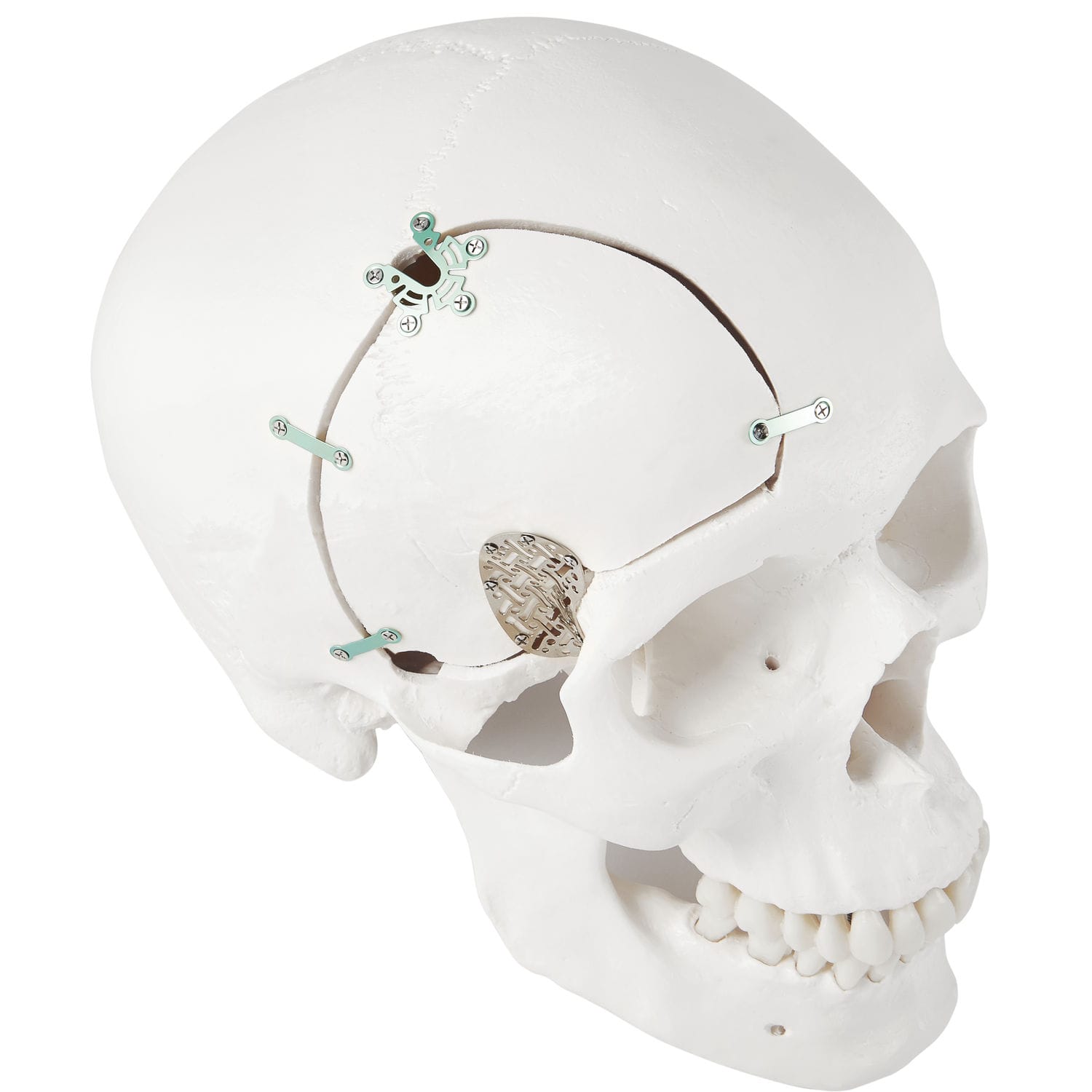 非吸収性頭蓋固定装置 - LeForte Neuro 0.3 - Jeil Medical Corporation