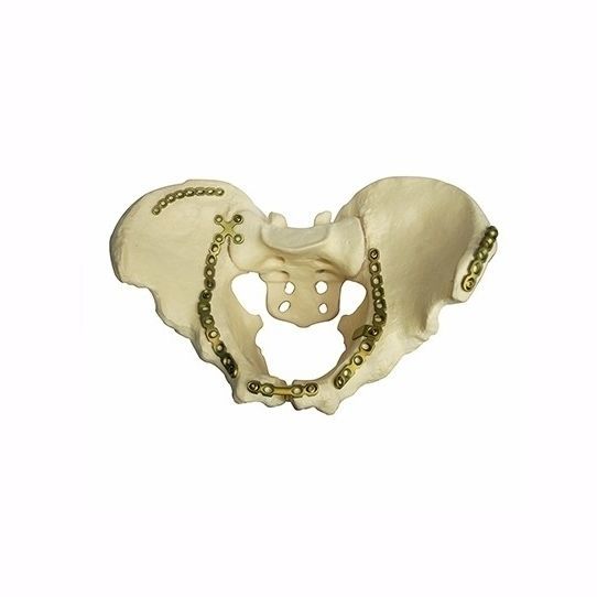 一宮の骨　 70575-17281322.jpg