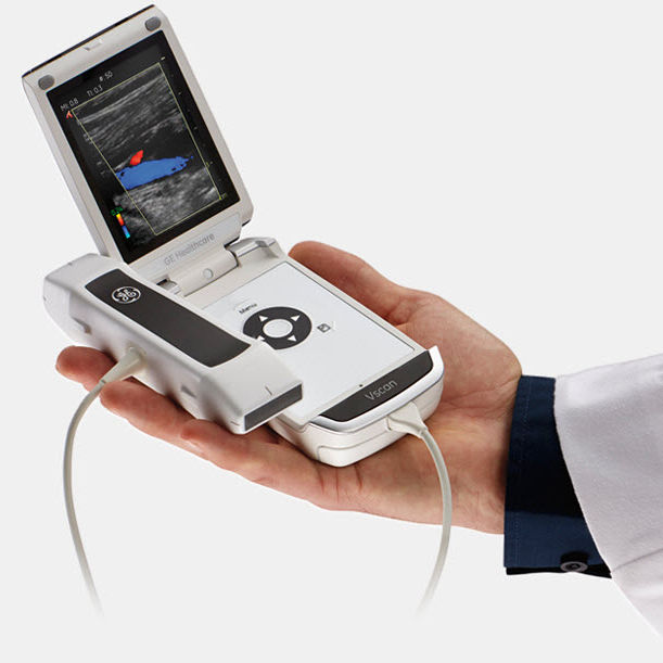 GE Healthcare Vscan ハンディスキャナー（GE HealthCare Launches 