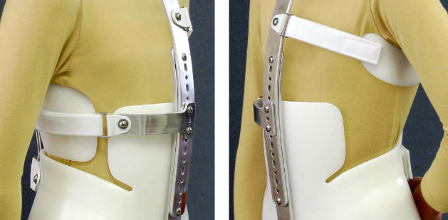 頸髄-胸髄-腰髄-仙髄サポートコルセット - Milwaukee - Spinal