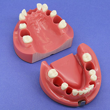 顎模型 ニッシン Nissin Medical Industries - 歯科衛生士 顎模型 歯石