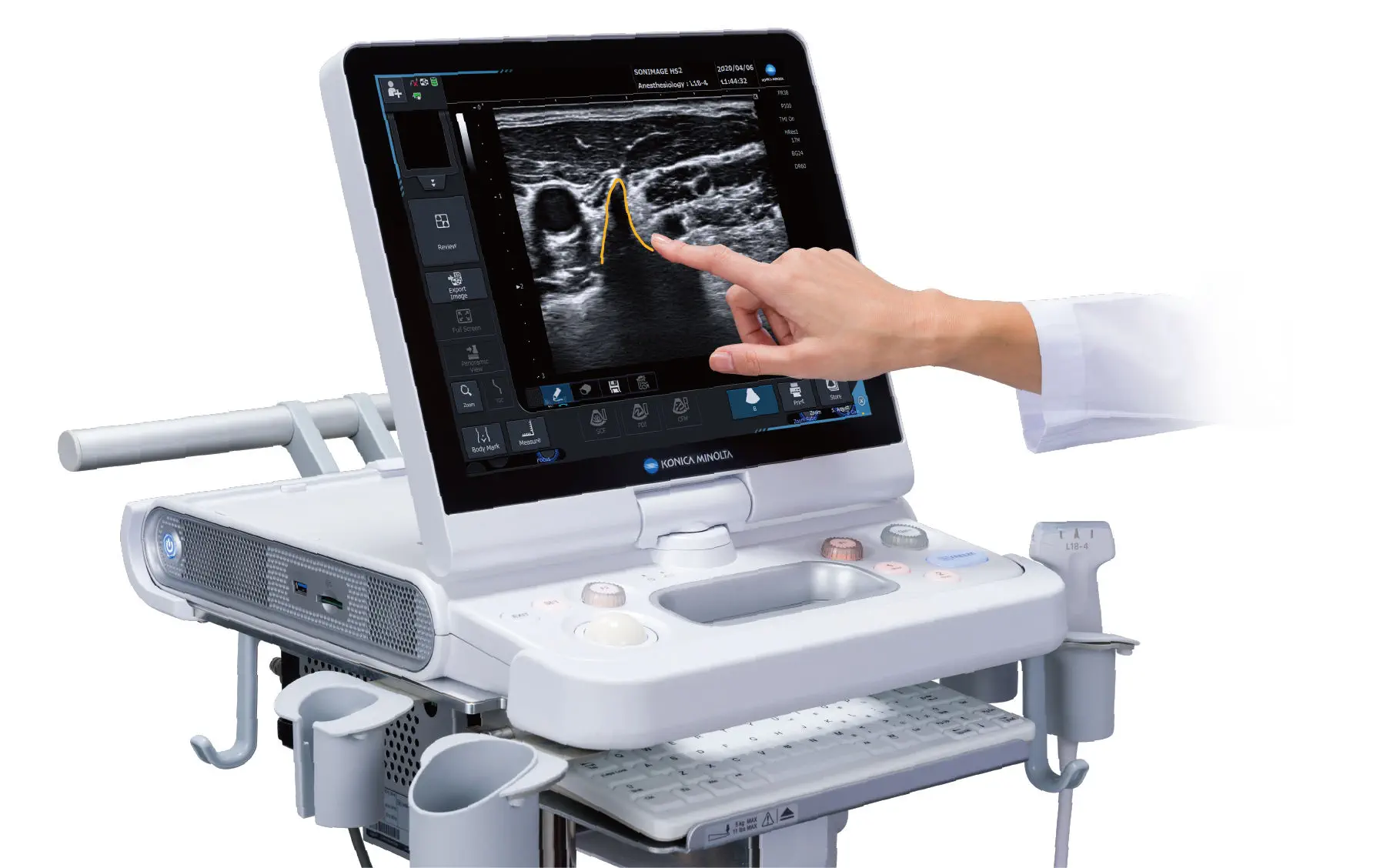 携帯型超音波装置 - SONIMAGE HS2 - Konica Minolta Healthcare/コニカ