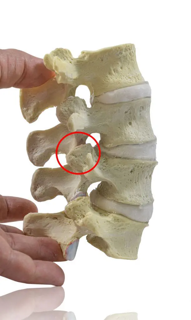 骨の解剖模型 - L2-5 - Dynamic Disc Designs Corp. - 椎骨の / 腰椎