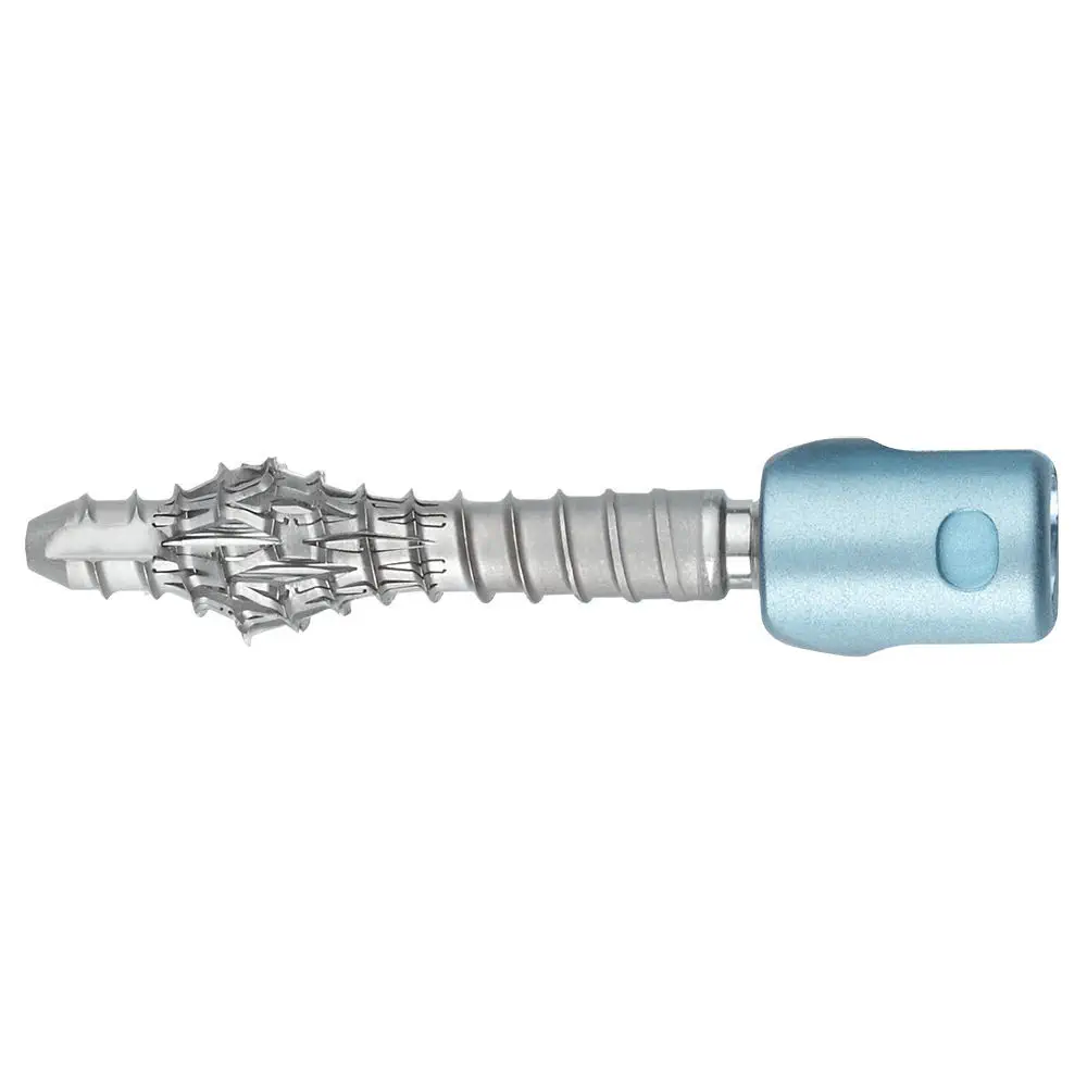 胸腰部脊椎用椎弓根スクリュー - OSSEOSCREW® - Alphatec Spine