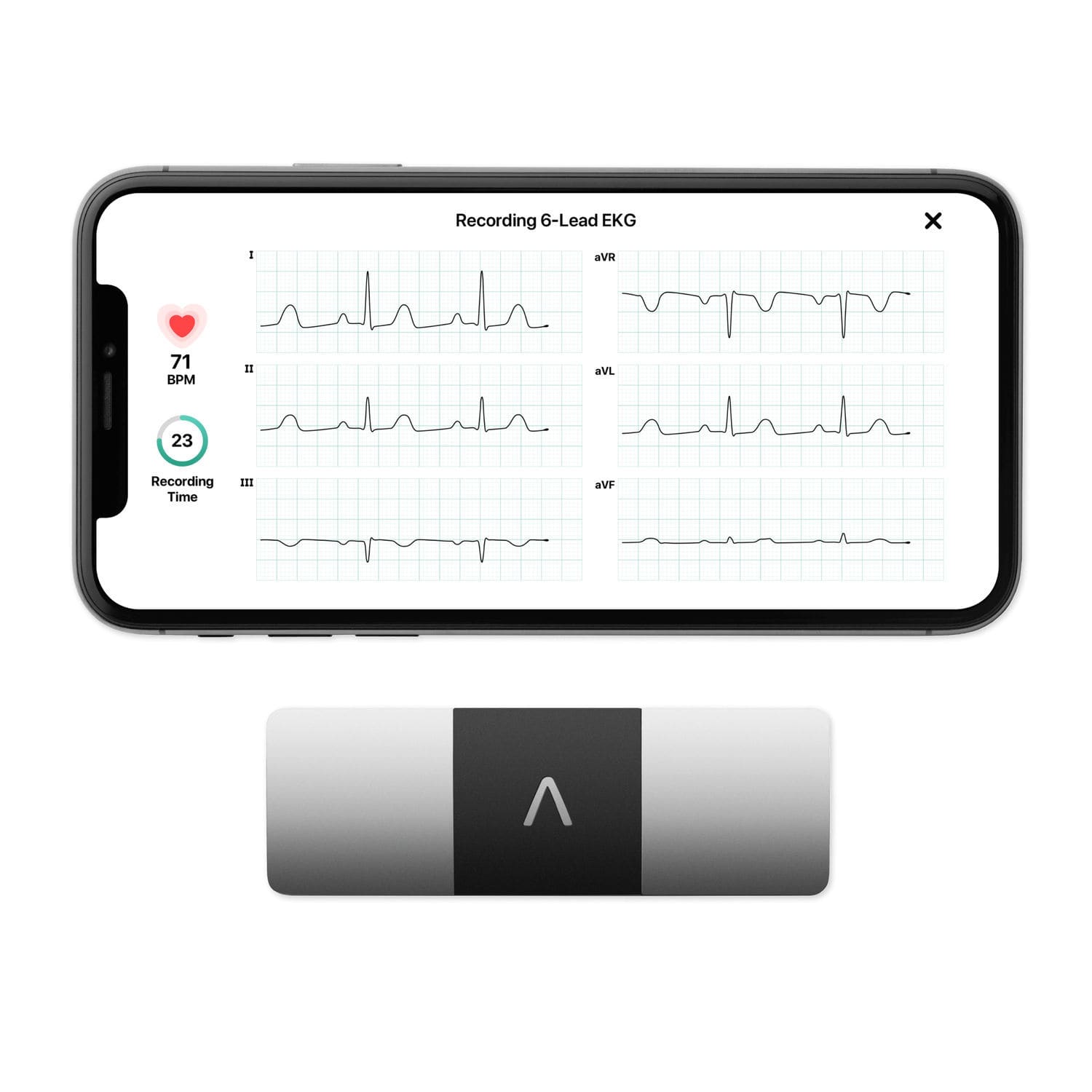 手持ち型患者モニター - KardiaMobile® 6L - AliveCor - ECG / 自宅