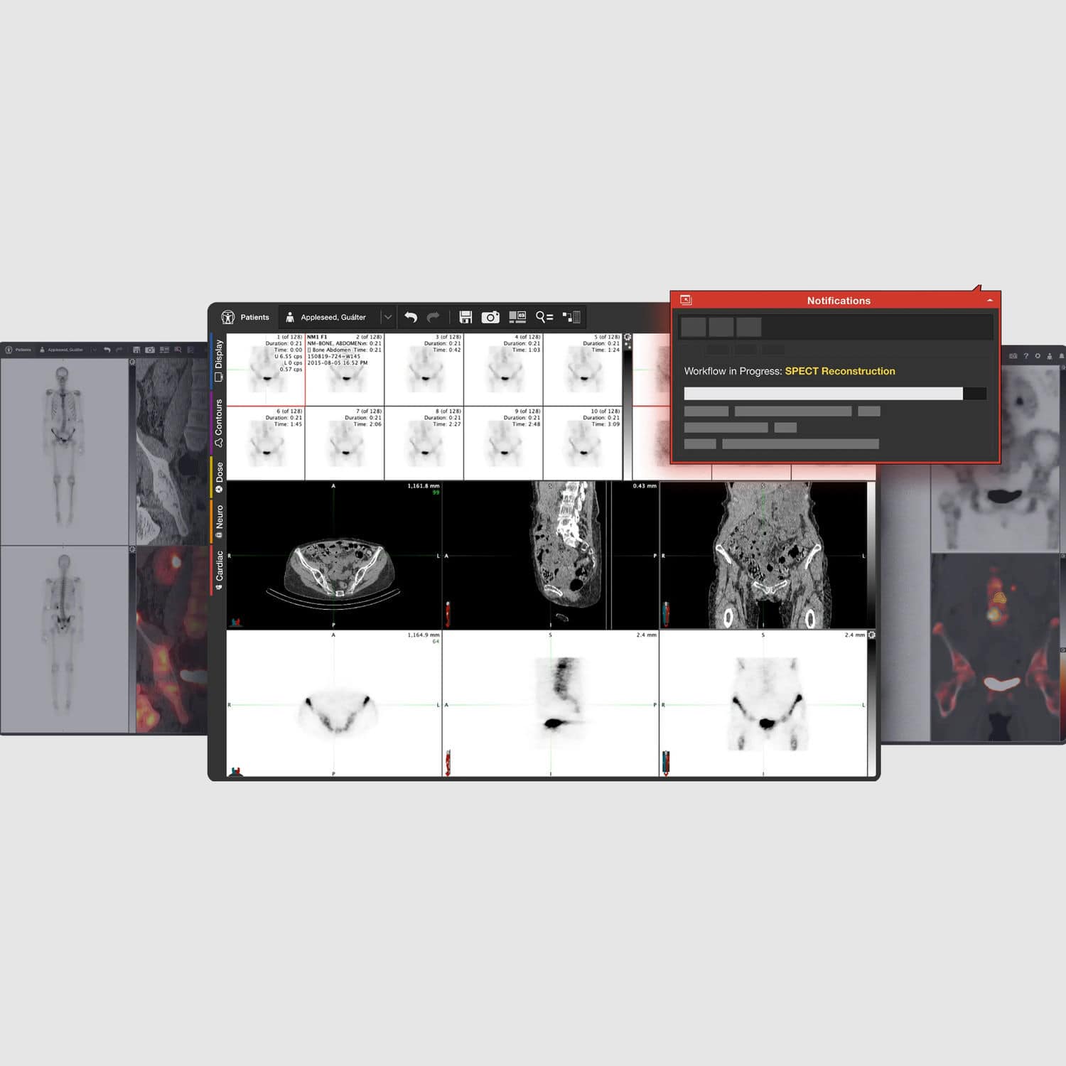分析ソフト - MIM Encore® - MIM Software - 可視化 / 診断用