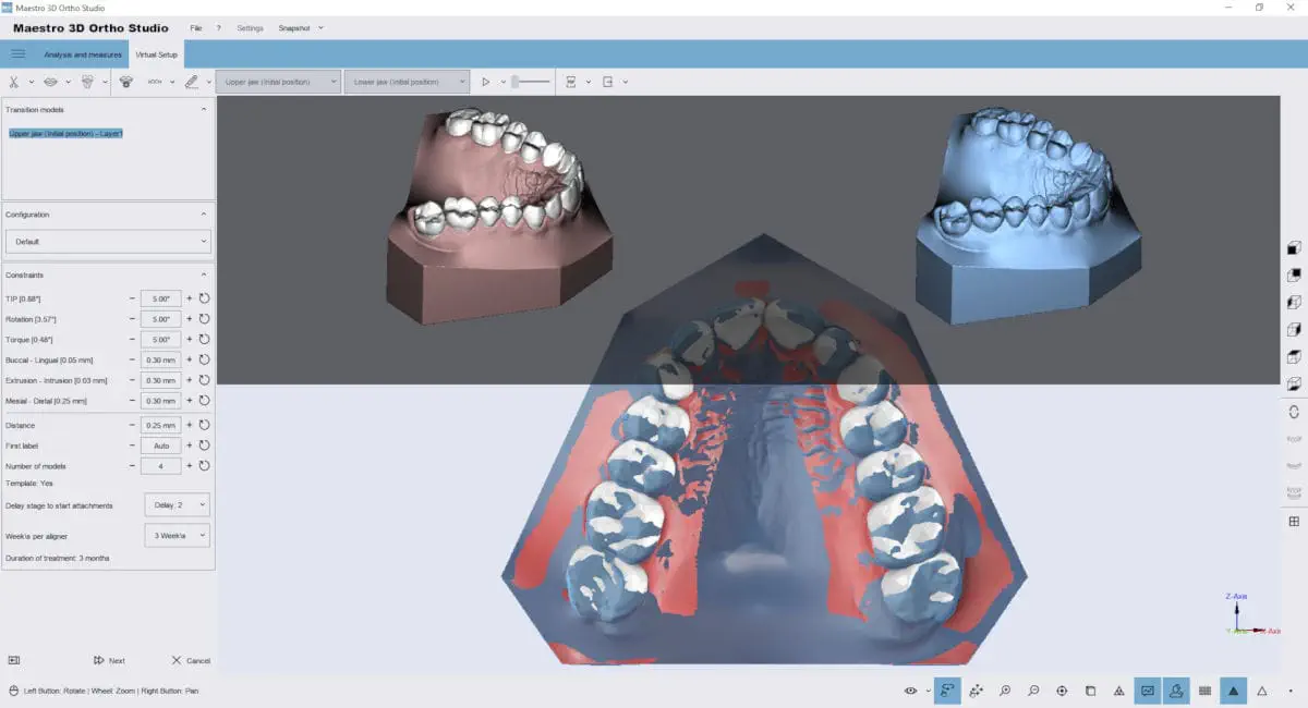 触診可動検査・ソフト徒手矯正法 分析ソフト - Ortho Studio - AGE Solutions - 3D ヴィジュアリ