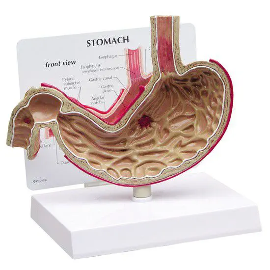 胃の解剖模型 - 2000 - GPI Anatomicals - 十二指腸 / 食道 / 実習用