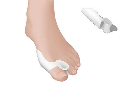 外反母趾 装具