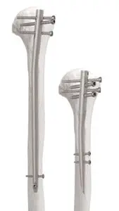 脛骨用髄内釘 - Da Vinci™ - AOS - Advanced Orthopaedic