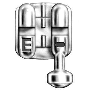 金属製矯正ブラケット