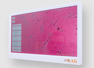 高解像度モニター