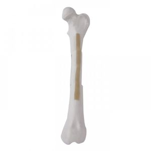大腿骨の解剖模型