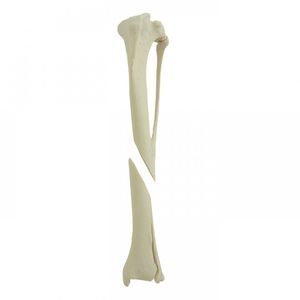 脛骨の解剖模型