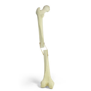 骨の解剖模型