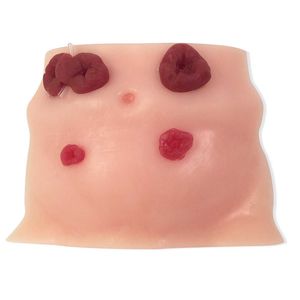 ストーマ ケア患者シミュレーター